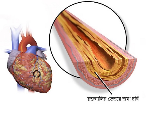 হার্টের রক্তনালি পরিষ্কারে সহায়ক চার প্রাকৃতিক পানীয়